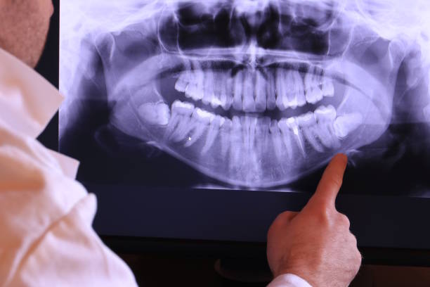 Best Emergency Treatment for Oral Infections in Sundown, TX