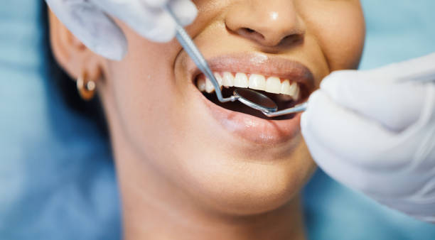 Best Broken or Chipped Tooth Repair in Sundown, TX