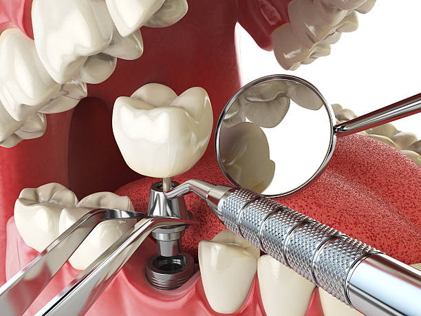 Best Dental Abscess Treatment in Sundown, TX